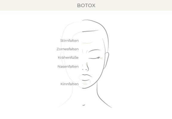 BTX, Dr. Eugenia Remmel, Plastische Chirurgie Zürich